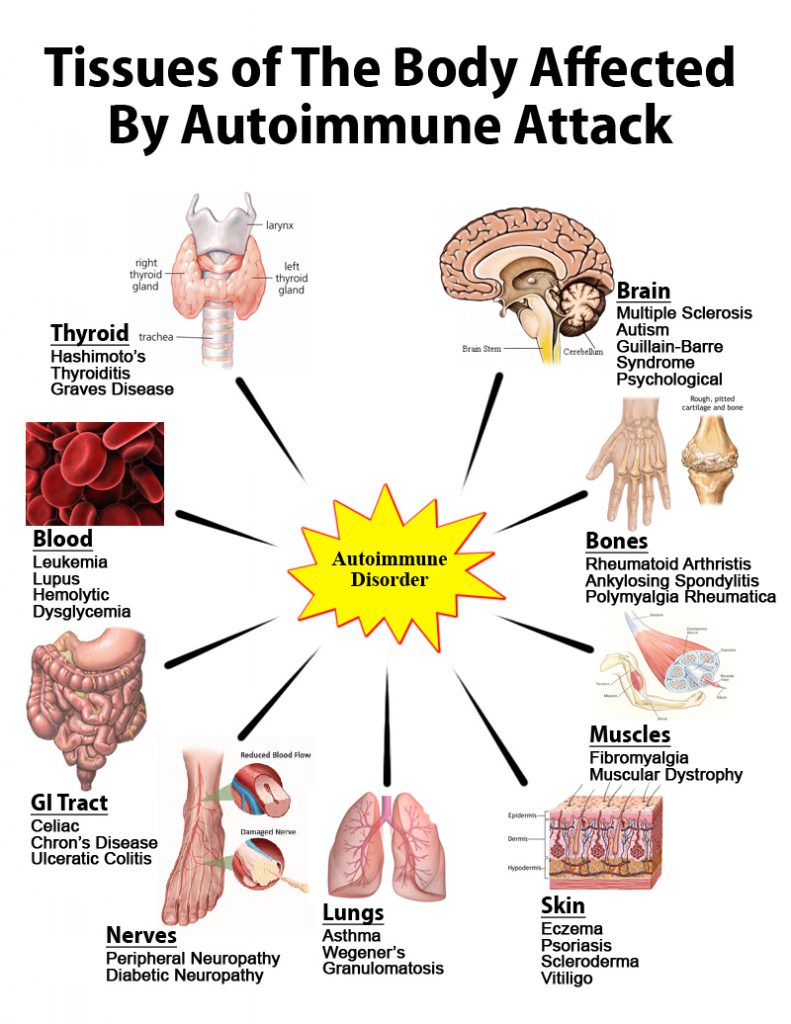 autoimmune_attack_graphic